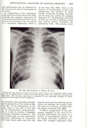 X-RAY DIAGNOSIS OF CHEST DISEASES