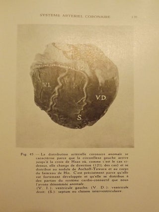 DIAGNOSTIC ANATOMO-TOPOGRAPHIQUE DE L'OBSTRUCTION ARTERIELLE CORONAIRE
